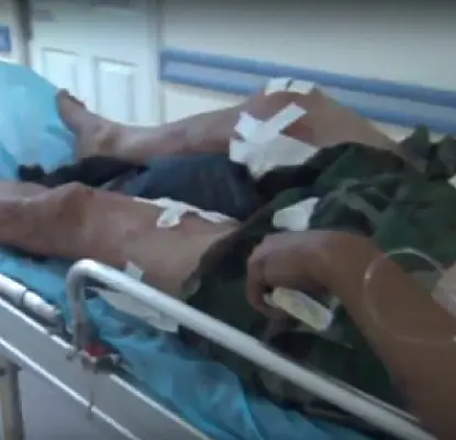 Two Gunmen Injured in Overnight Fire Exchange Between Police and ‘Daredevils of Sasun’ 
