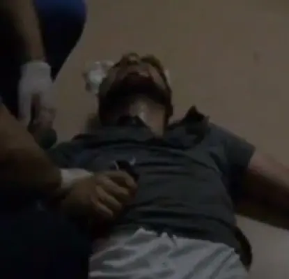 Люди в штатском волокли потерявшего сознание армянского политика по коридору больницы