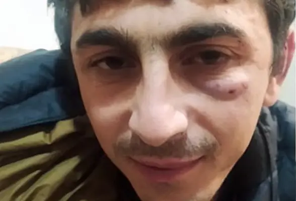 «При касании острых частей двери автомобиля». Пытки в полиции Ванадзора