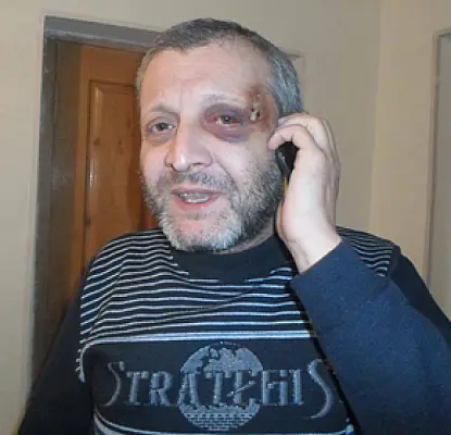 Избитый депутатом армянский политолог не видит в этом политики