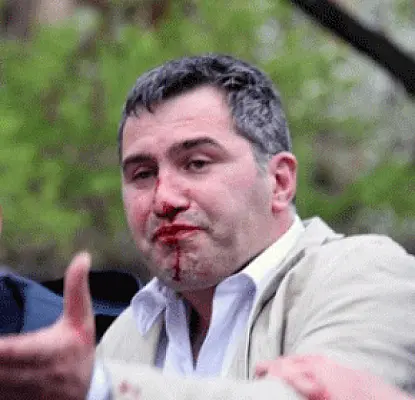Избитый армянский оппозиционер вступился за мать и дочь