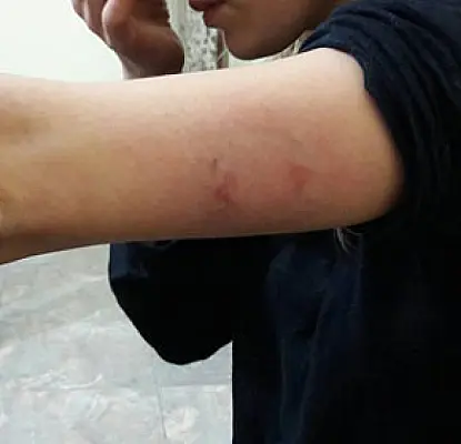 Woman Cruelly Beaten on Yerevan Street by Husband