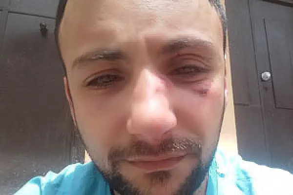 Вынужден совершить самосуд над кочаряно-дашнаками