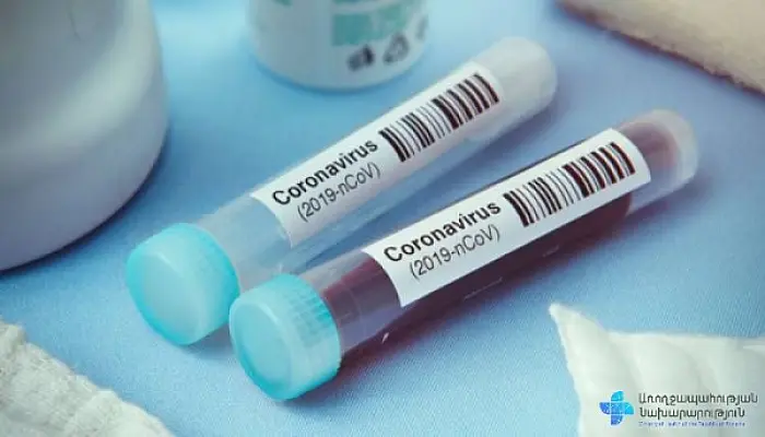 584 новых случая заражения Covid-19 выявили в Армении