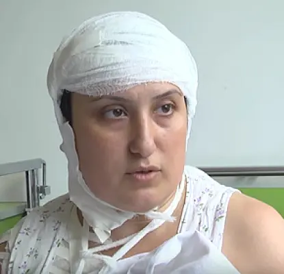 «Набросился на меня с топором» - пострадавшие рассказали о жестокой бойне в Ереване